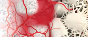 Substitutos ósseo sintético . Synthetic bone substitutes . Sustitutos óseos sintéticos